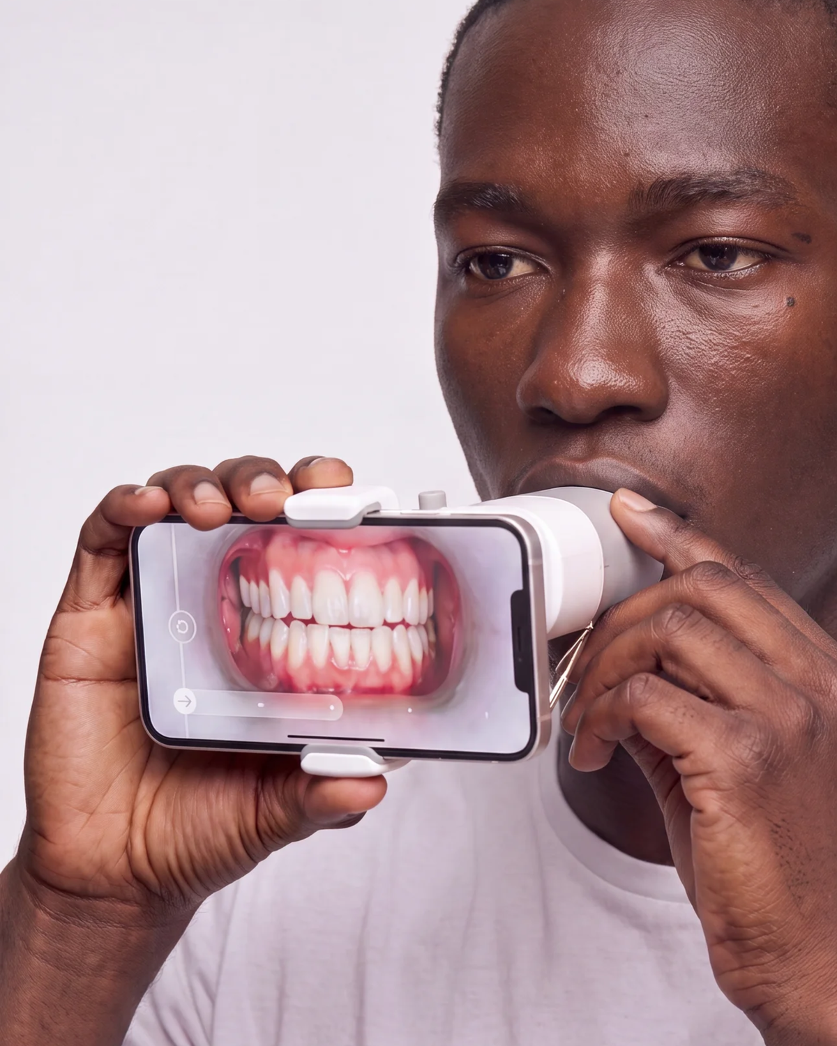 Clear Aligners Aalto