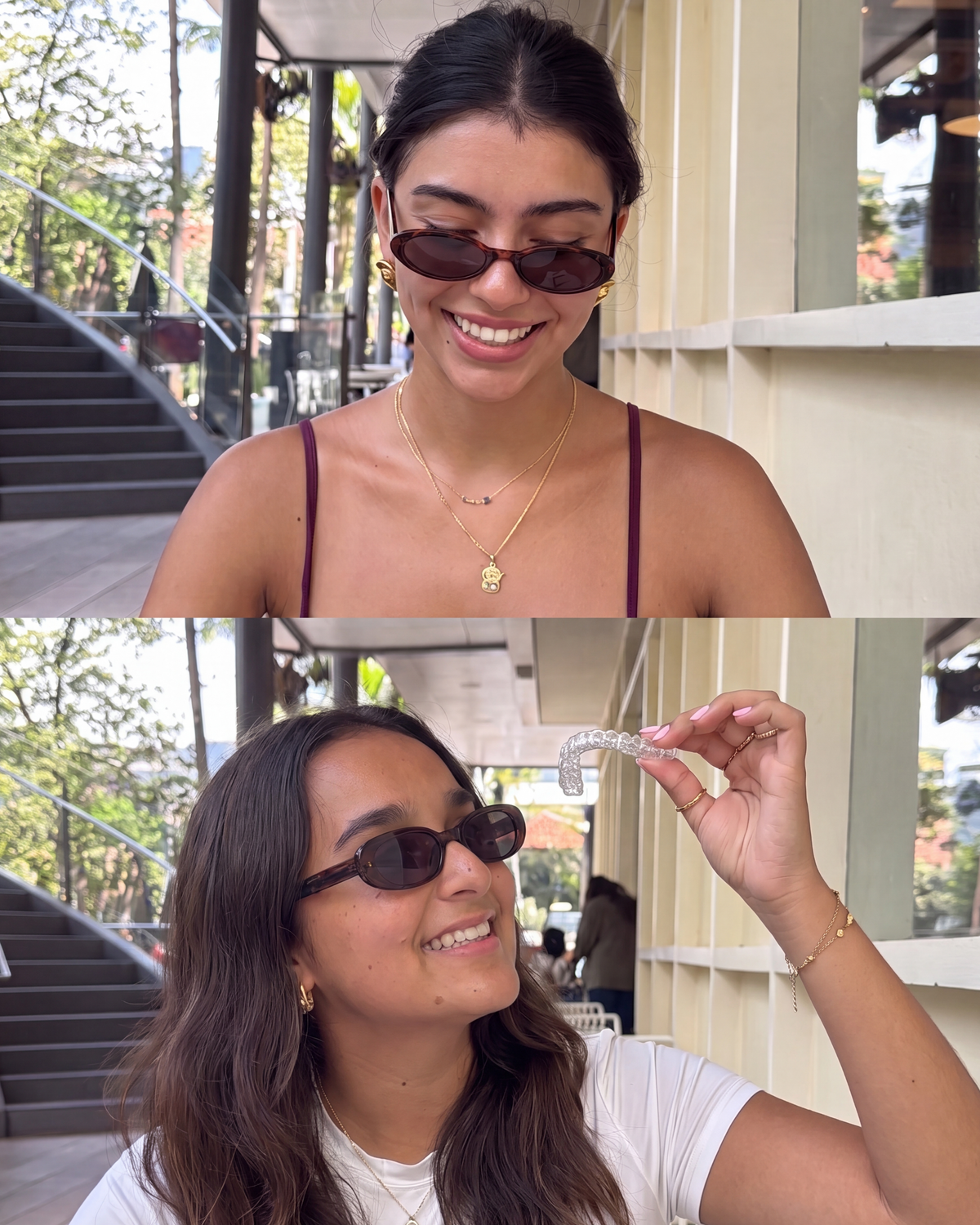 clear aligners