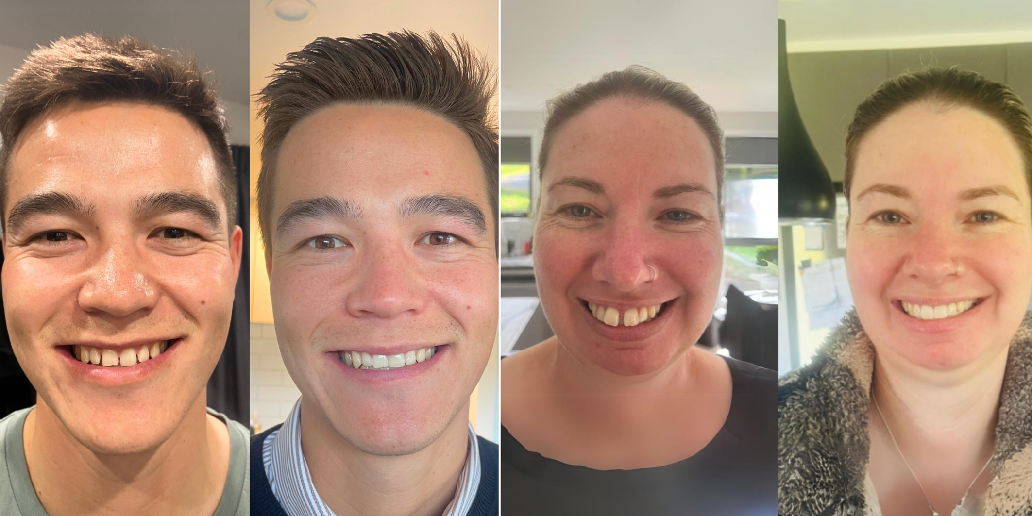 Close Gaps & Transform Your Smile with Aalto Clear Aligners