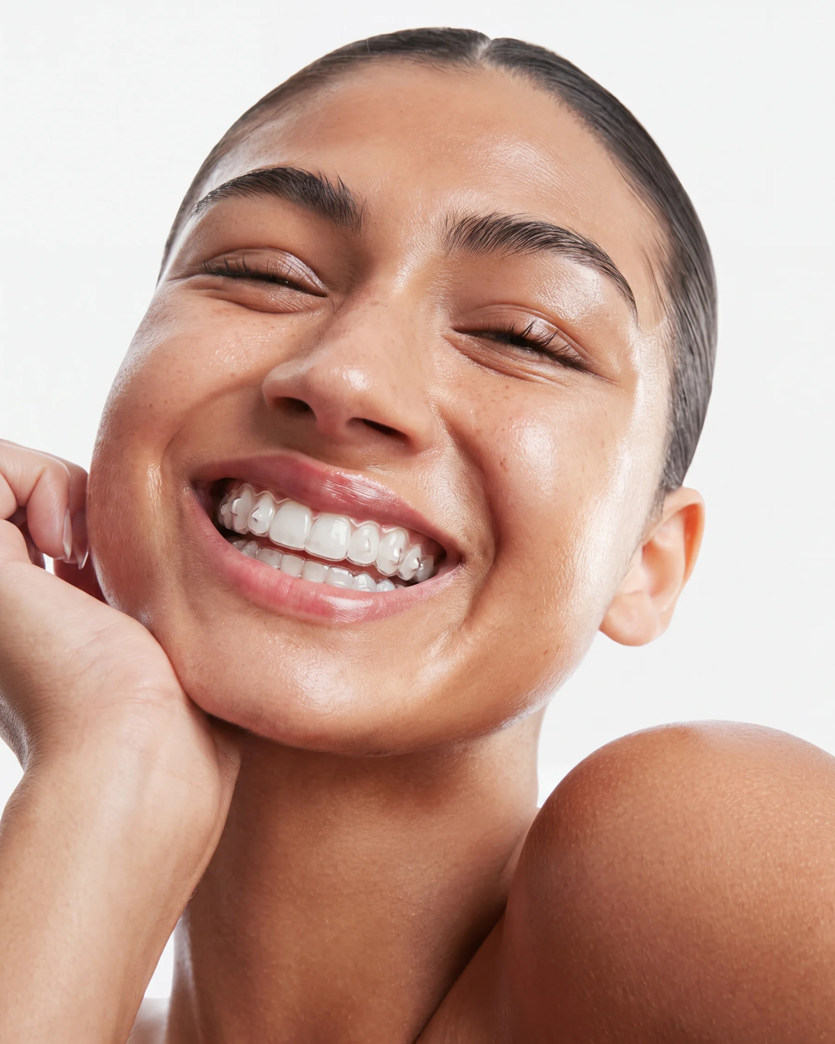 Aalto Attachments for Clear Aligners