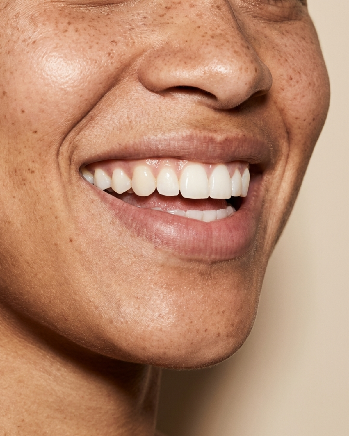 Gum Disease Aalto