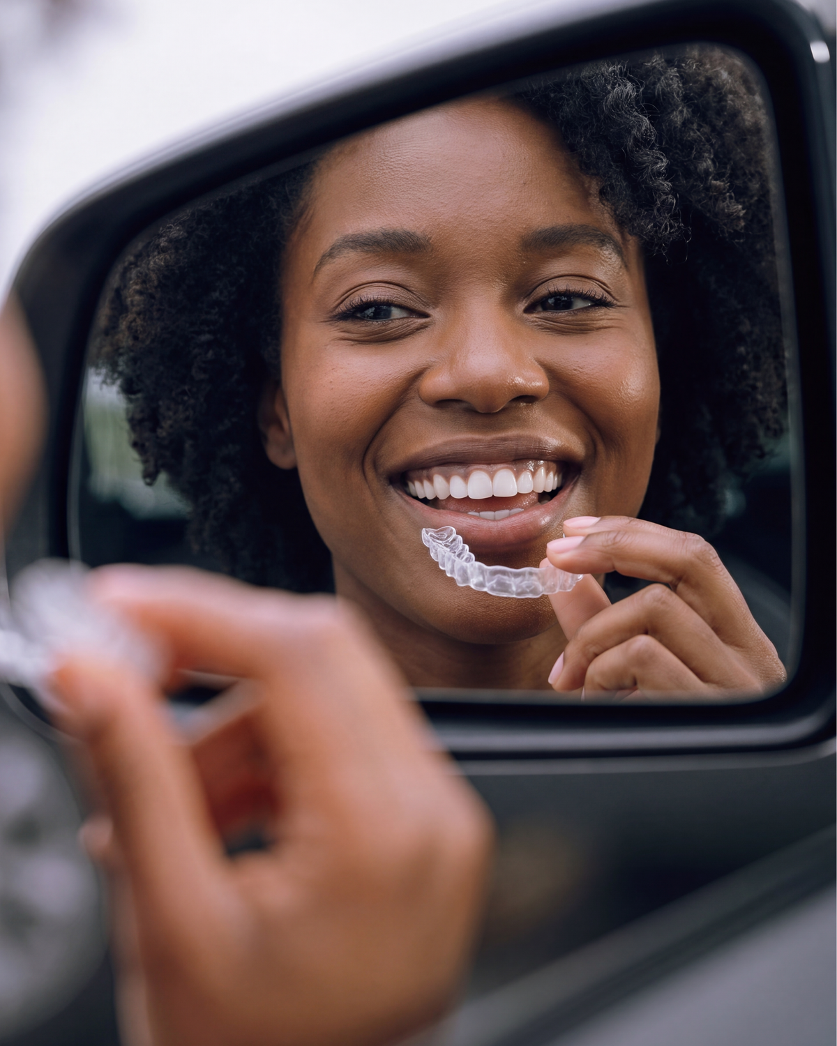 clear aligners
