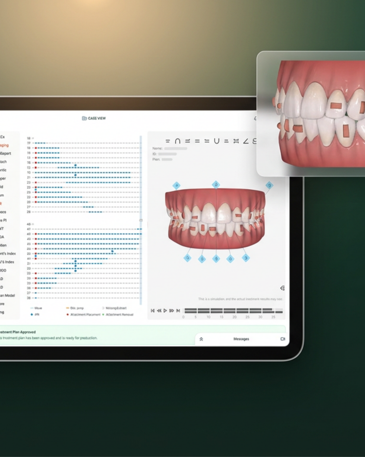 clear aligner, cross bite