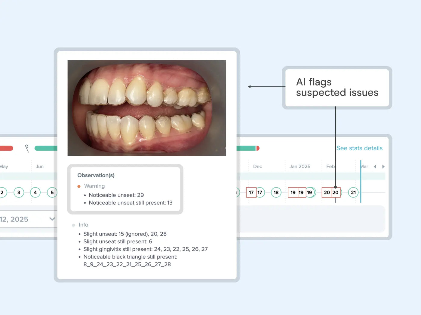 Aligner fit